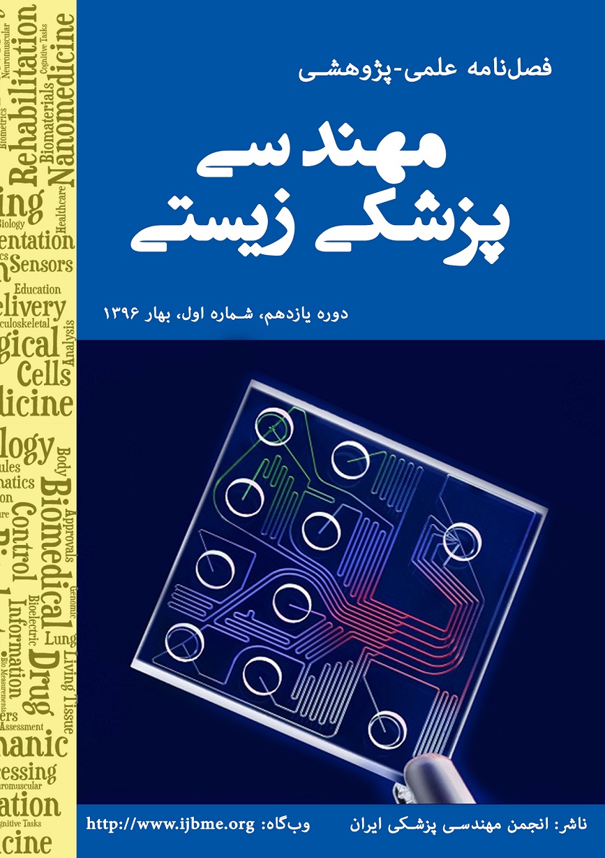 Iranian Journal of Biomedical Engineering